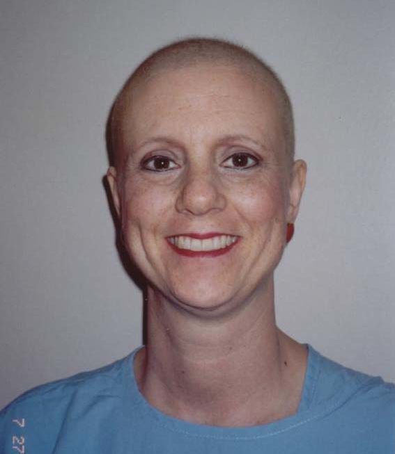A woman with a shaved head smiling for the camera.