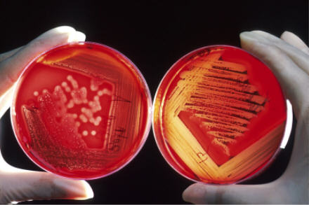 A person holding up two petri dishes with different bacteria on them.